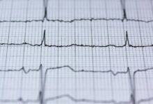 neural apex pulse technology